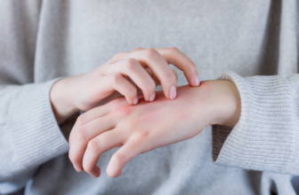 Why Dermatologists Are Watching This Eczema Treatment Closely